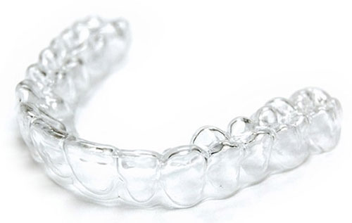 Invisalign Tucson, AZ - Old Pueblo Dental